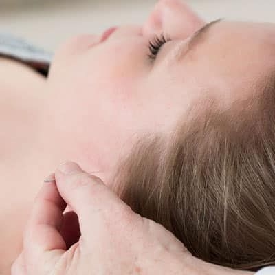 Ooracupunctuur (auriculotherapie) bij Medivisie